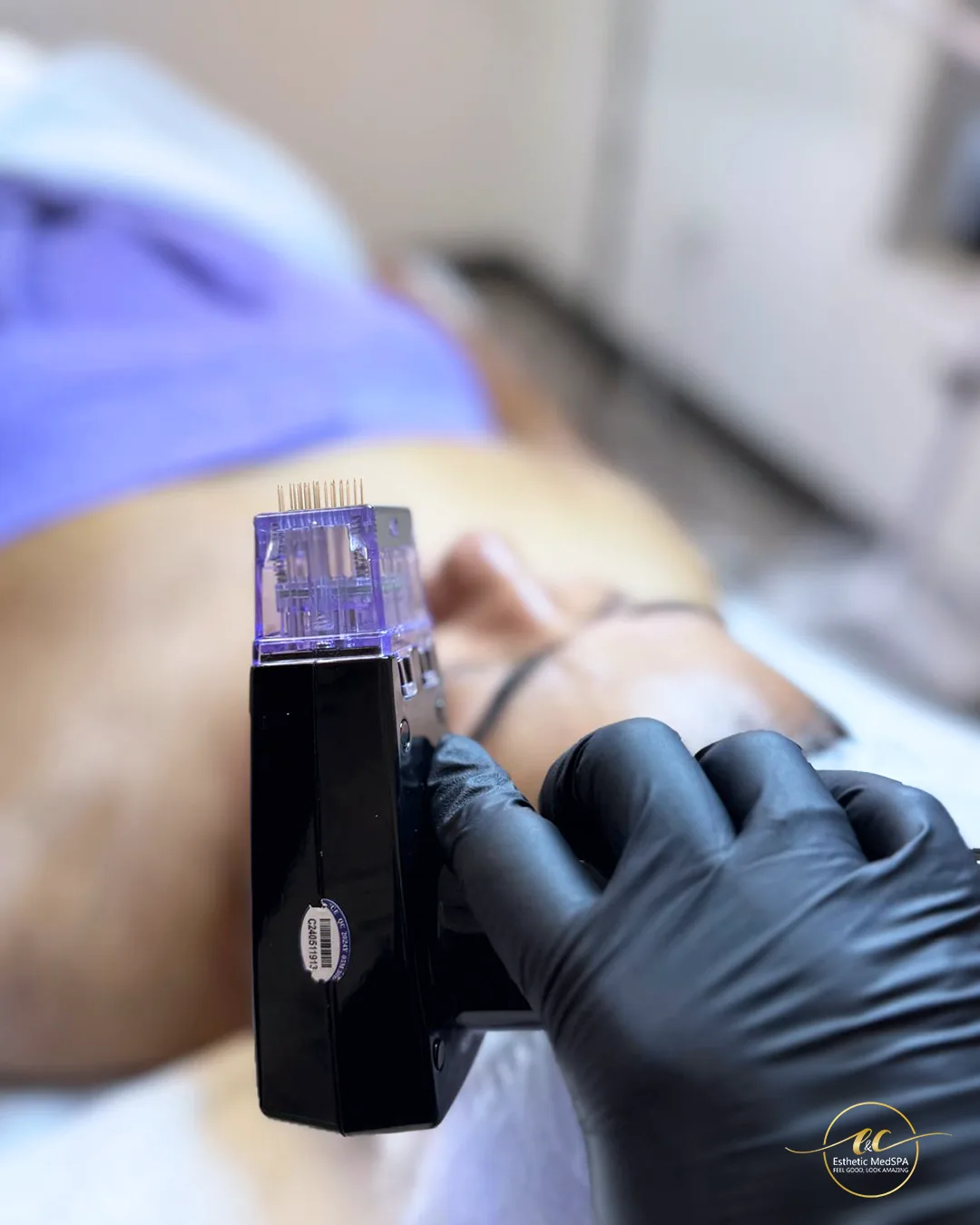 Morpheus8 body treatment at E&C Esthetic Med Spa