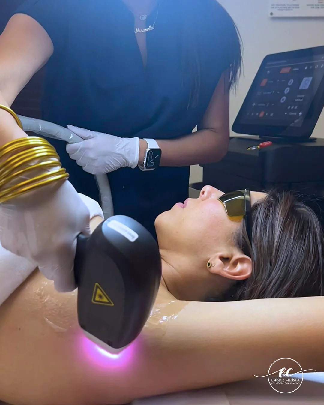 Diode laser treatment at E&C Esthetic Med Spa